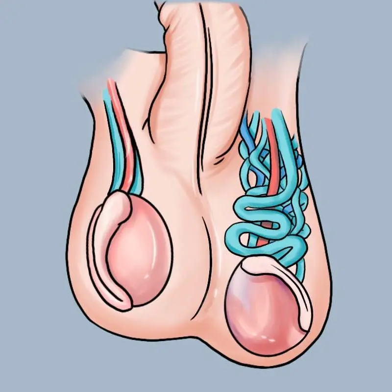 兩側睪丸大小不一致