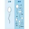 展示正常精子對比畸形精子