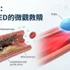 威而鋼對器質性ED（如糖尿病引起）的效果如何