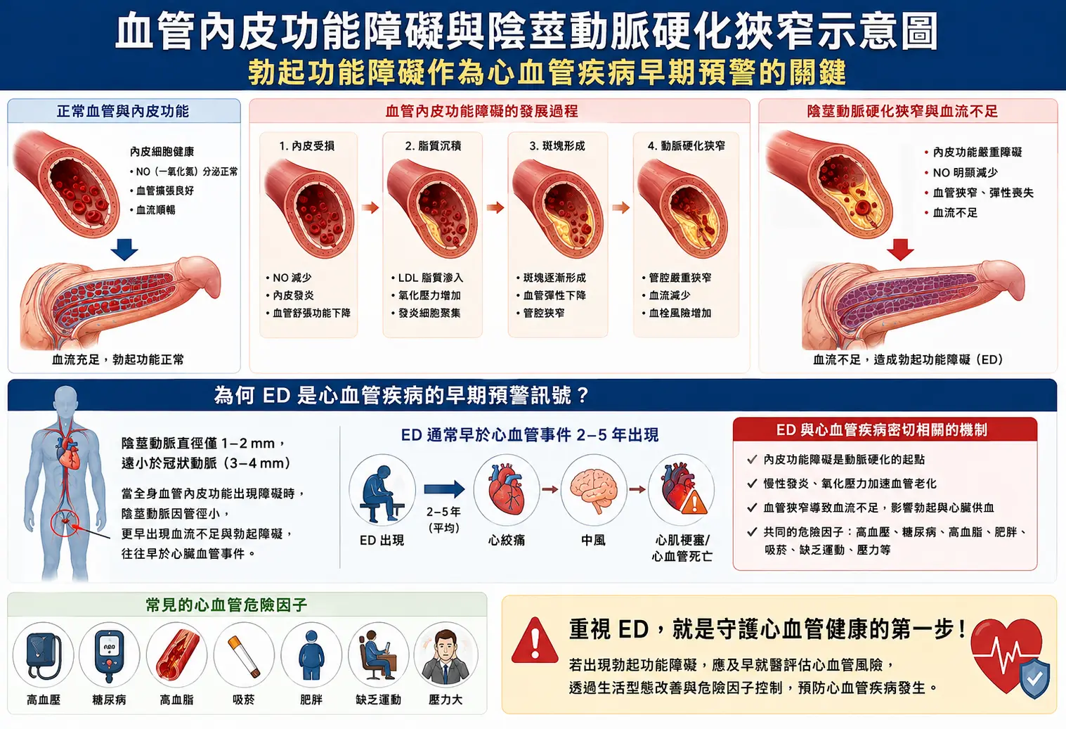 血管內皮功能障礙與陰莖動脈硬化狹窄示意圖，說明勃起功能障礙作為心血管疾病早期預警的關鍵
