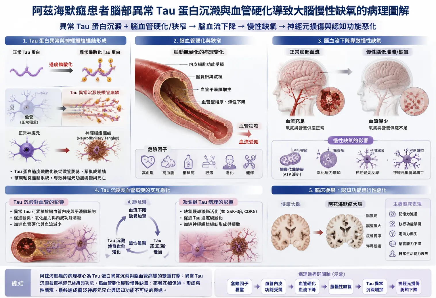 阿茲海默癥患者腦部異常Tau蛋白沈澱與血管硬化導致大腦慢性缺氧的病理圖解